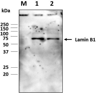 Western blot image