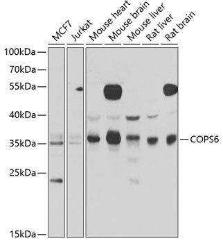 Western blot