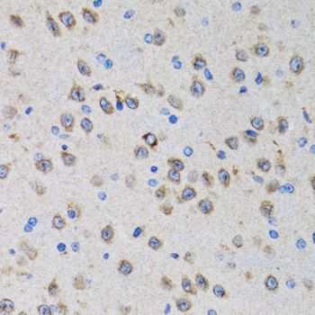 Immunohistochemistry - PGRMC1 antibody (144-05619)