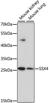 Western blot - SSX4 antibody (144-61453)