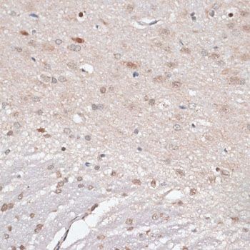 Immunohistochemistry - AHSP Polyclonal Antibody (144-06465)