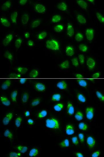 Immunofluorescence - TLR1 Polyclonal Antibody (144-00997)