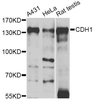 Immunohistochemistry - CDH1 Polyclonal Antibody (144-011492)