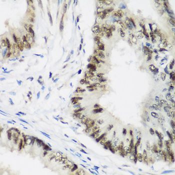 Immunohistochemistry - AEBP2 antibody (144-07400)