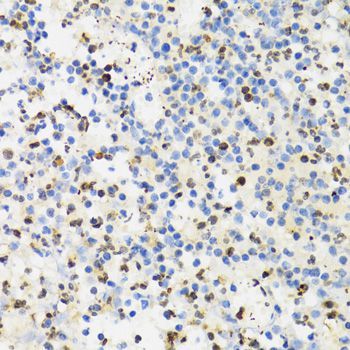 Immunohistochemistry - SUMO4 Antibody (144-03100)