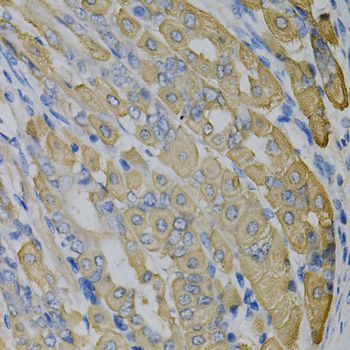 Immunohistochemistry - [KO Validated] GLUL Polyclonal Antibody (144-05437)