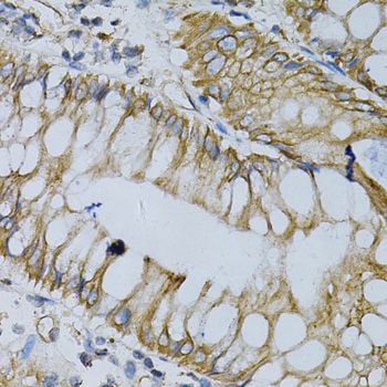 Immunohistochemistry - NPC2 Antibody (144-05413)