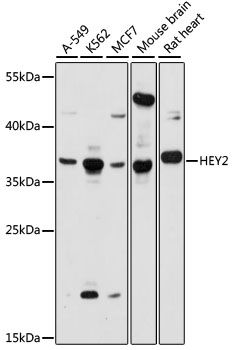 Western blot