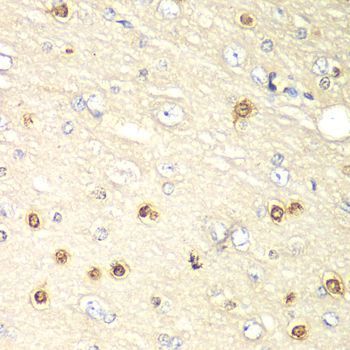 Immunohistochemistry - HIF1AN antibody (144-05466)