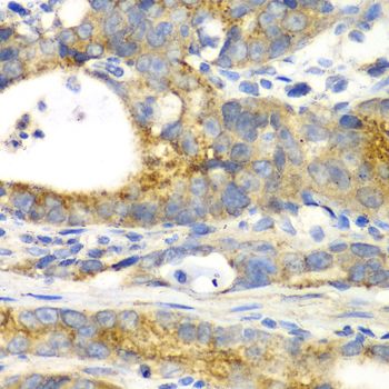 Immunohistochemistry - GORASP1 antibody (144-06609)
