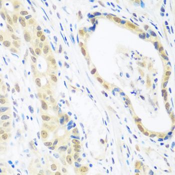 Immunohistochemistry - POLR2E Polyclonal Antibody (144-01755)
