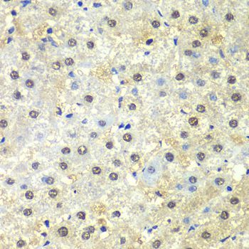 Immunohistochemistry - PSMD13 antibody (144-06956)