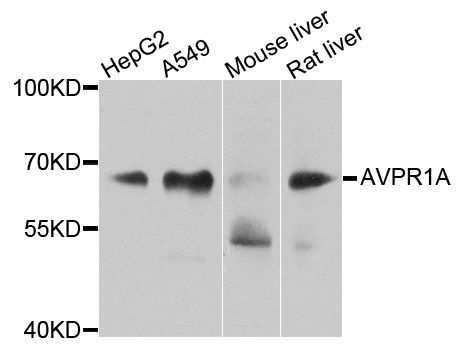Western blot - AVPR1A antibody (144-08400)