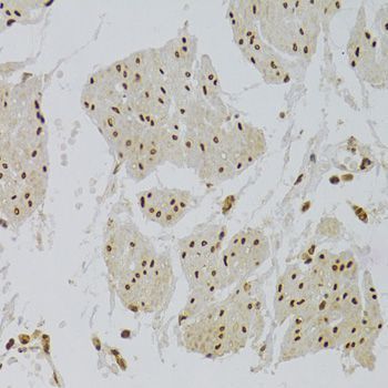 Immunohistochemistry - XRCC6 Polyclonal Antibody (144-00883)