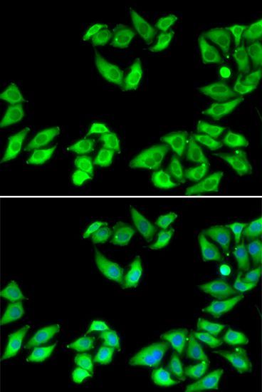 Immunohistochemistry - RPS14 Polyclonal Antibody (144-06727)