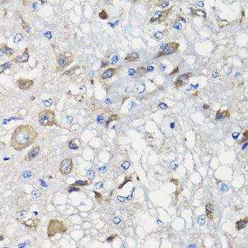 Immunohistochemistry - BCS1L antibody (144-07647)
