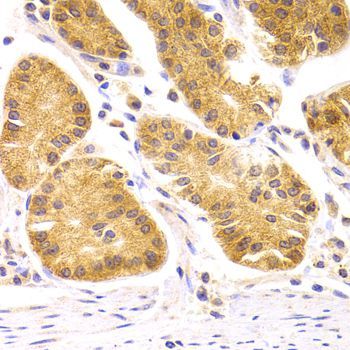 Immunohistochemistry - SCO2 Polyclonal Antibody (144-07051)