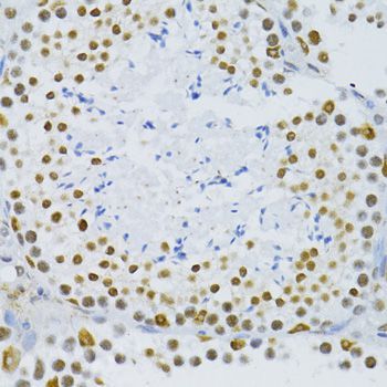 Immunohistochemistry - SNRNP70 antibody (144-06065)