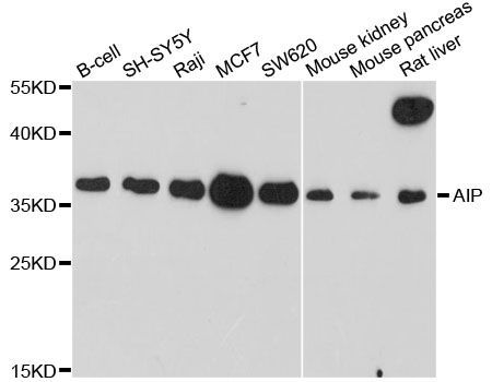 Western blot - AIP antibody (144-012546)