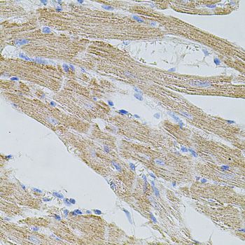 Immunohistochemistry - TRPA1 Polyclonal Antibody (144-08568)
