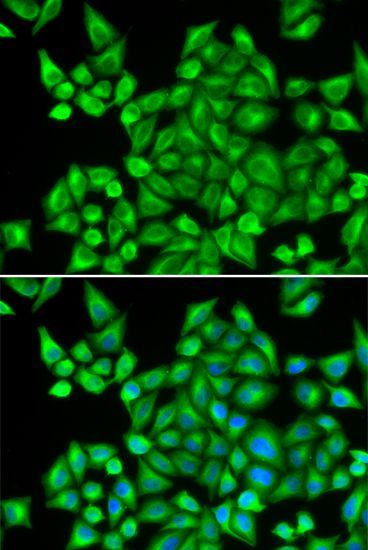 Immunofluorescence - DHRS9 Polyclonal Antibody (144-06324)