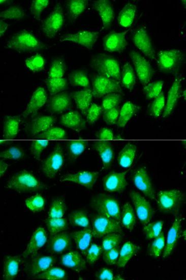 Western blot - RAN Polyclonal Antibody (144-00976)