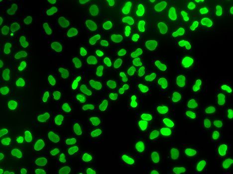 Immunohistochemistry - [KO Validated] TMPO Polyclonal Antibody (144-02534)