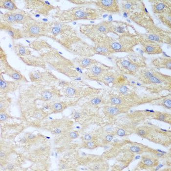Immunohistochemistry - NUDT15 antibody (144-08368)
