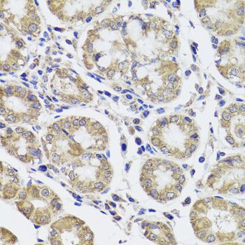 Immunohistochemistry - CTSC antibody (144-08403)