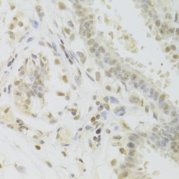 Immunohistochemistry - PRPF3 Polyclonal Antibody (144-05482)