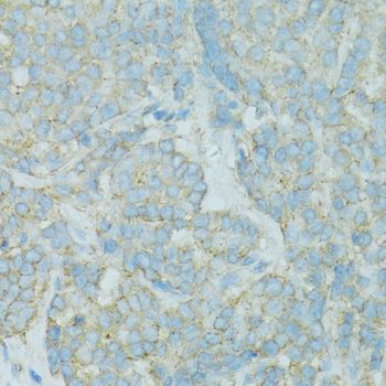 Immunohistochemistry - TJP2 Polyclonal Antibody (144-00594)