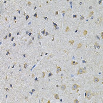 Immunohistochemistry - PPA1 Antibody (144-02108)
