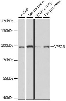 Western blot - VPS16 antibody (144-015888)