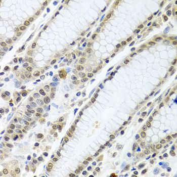Immunohistochemistry - TIA1 antibody (144-12523)