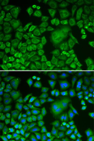 Western blot - ACTR3 Polyclonal Antibody (144-01064)