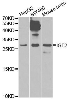 Western blot - IGF2 Polyclonal Antibody (144-02086)