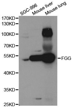 Western blot - FGG Polyclonal Antibody (144-05642)