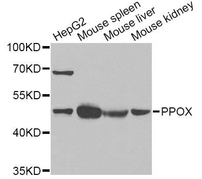 Western blot - PPOX Polyclonal Antibody (144-06397)