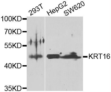 Western blot - KRT16 antibody (144-07493)