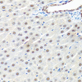 Immunohistochemistry - PRPF19 Polyclonal Antibody (144-12590)