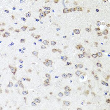 Immunohistochemistry - IGFBP5 antibody (144-012451)