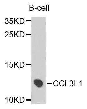 Western blot - CCL3L1 antibody (144-02852)