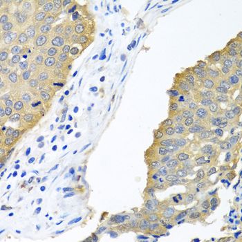Immunohistochemistry - EIF4E Polyclonal Antibody (144-02162)
