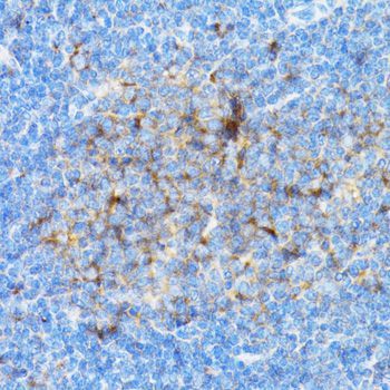 Immunohistochemistry - SIAH1 antibody (144-02494)