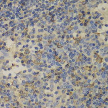 Immunohistochemistry - FTL antibody (144-01768)