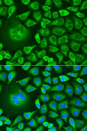 Immunofluorescence - UBIAD1 antibody (144-014214)