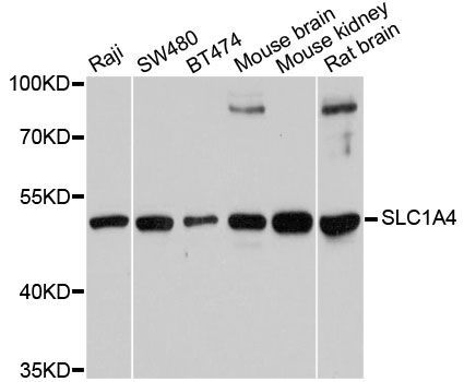 Western blot - SLC1A4 antibody (144-12507)