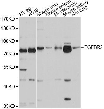 Western blot - TGFBR2 Polyclonal Antibody (144-01415)