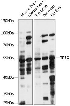 Western blot