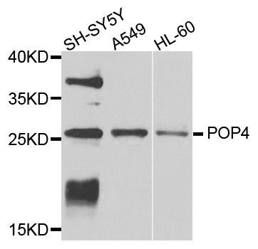 Western blot - POP4 antibody (144-04452)